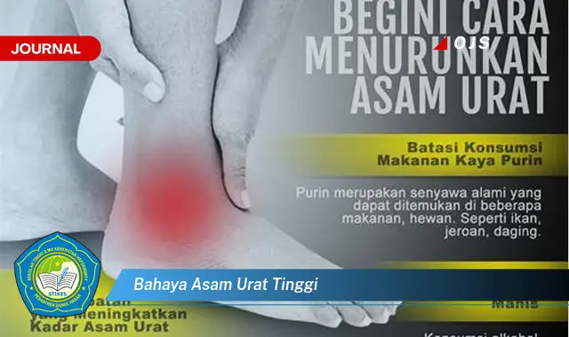 bahaya asam urat tinggi