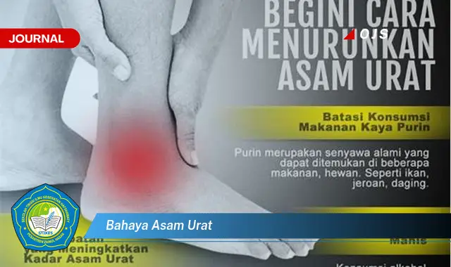 bahaya asam urat