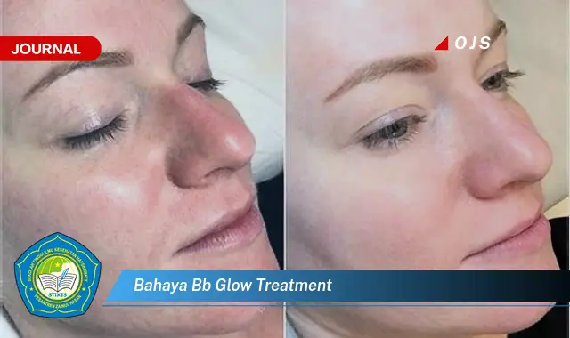 bahaya bb glow treatment bahaya bb glow treatment