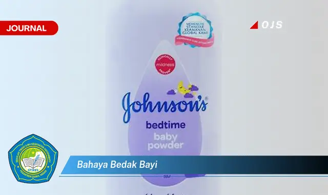 bahaya bedak bayi