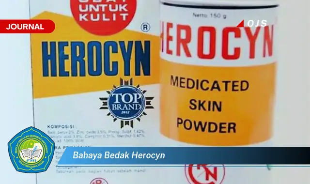 bahaya bedak herocyn