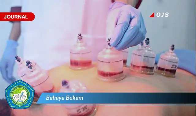 bahaya bekam