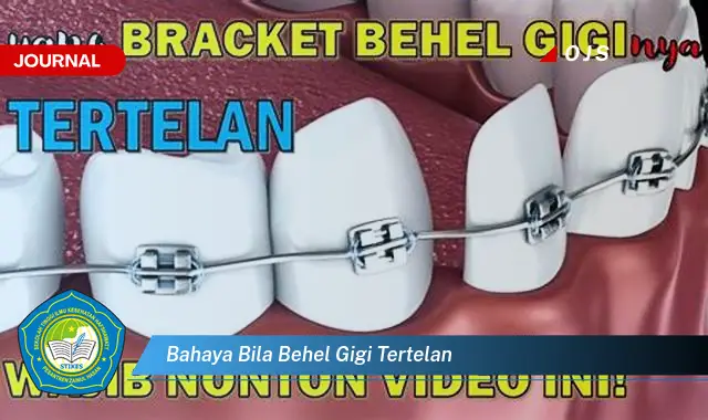 bahaya bila behel gigi tertelan