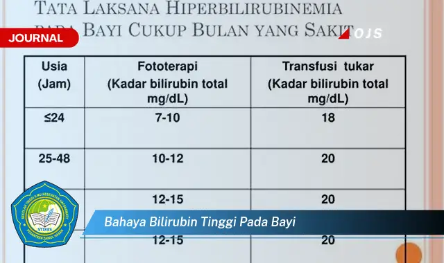 bahaya bilirubin tinggi pada bayi