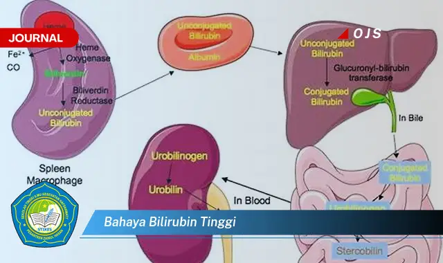 bahaya bilirubin tinggi