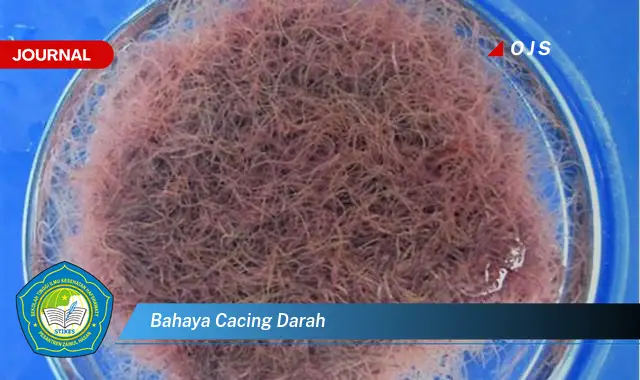 Inilah 15 Bahaya Cacing Darah yang Wajib Diketahui
