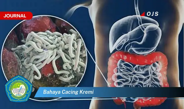 bahaya cacing kremi bahaya cacing kremi