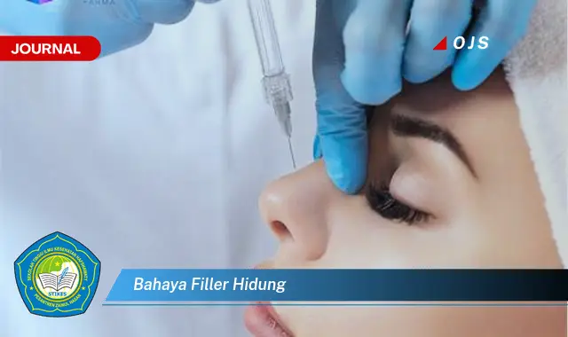 bahaya filler hidung
