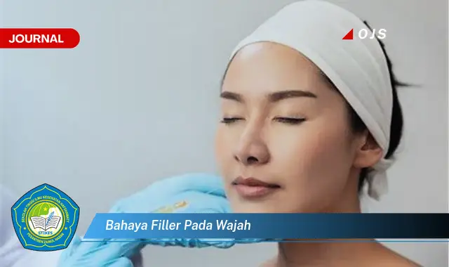 bahaya filler pada wajah