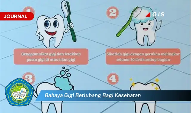 bahaya gigi berlubang bagi kesehatan