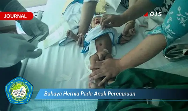 bahaya hernia pada anak perempuan