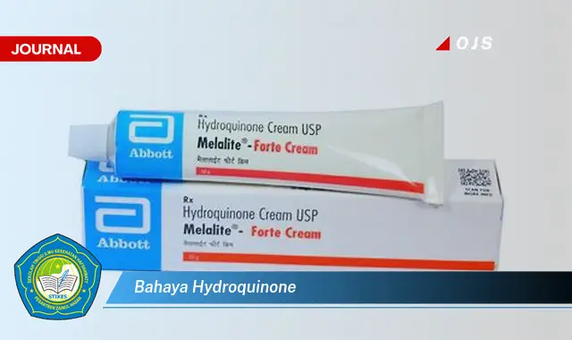 bahaya hydroquinone bahaya hydroquinone