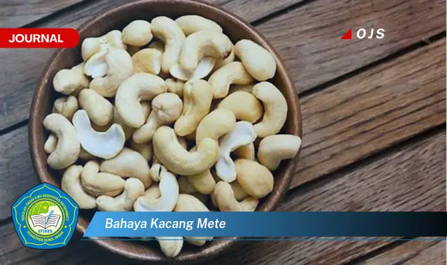bahaya kacang mete