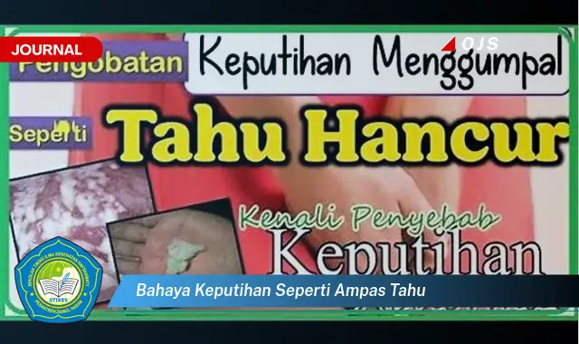 bahaya keputihan seperti ampas tahu