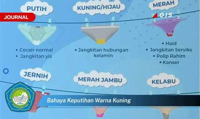 bahaya keputihan warna kuning