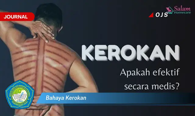 bahaya kerokan