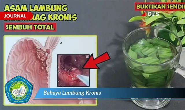 bahaya lambung kronis