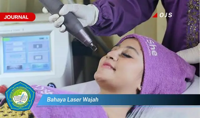 bahaya laser wajah