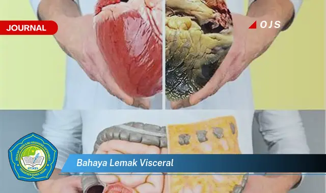 bahaya lemak visceral