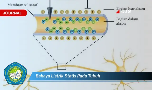 bahaya listrik statis pada tubuh bahaya listrik statis pada tubuh