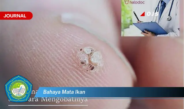 bahaya mata ikan bahaya mata ikan