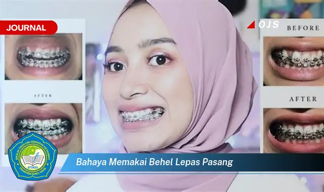 bahaya memakai behel lepas pasang