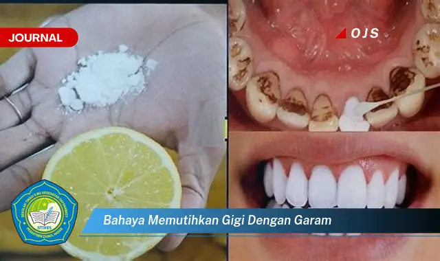 bahaya memutihkan gigi dengan garam