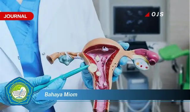 bahaya miom bahaya miom
