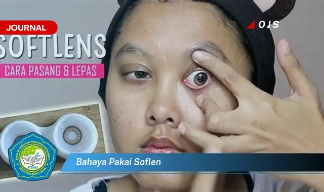 bahaya pakai soflen