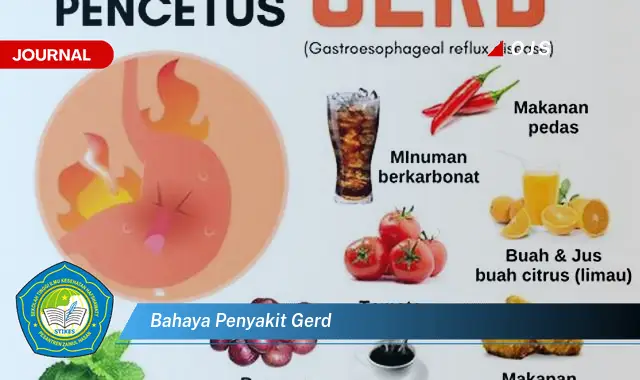 bahaya penyakit gerd bahaya penyakit gerd