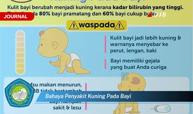 bahaya penyakit kuning pada bayi