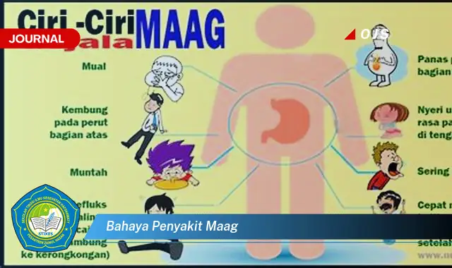 bahaya penyakit maag
