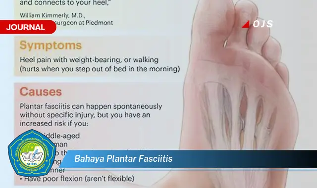 bahaya plantar fasciitis