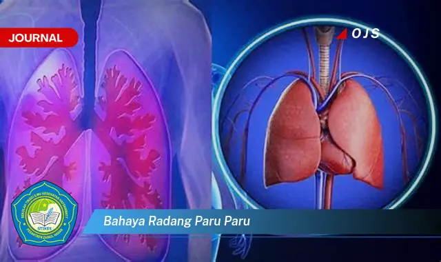 bahaya radang paru paru