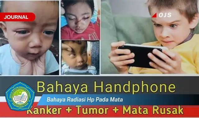bahaya radiasi hp pada mata
