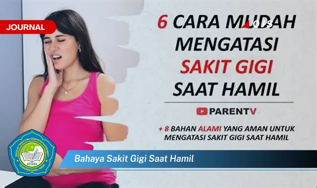 bahaya sakit gigi saat hamil