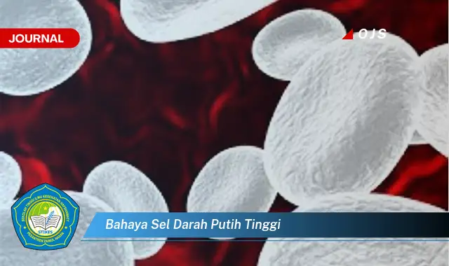bahaya sel darah putih tinggi