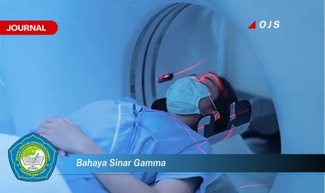 bahaya sinar gamma