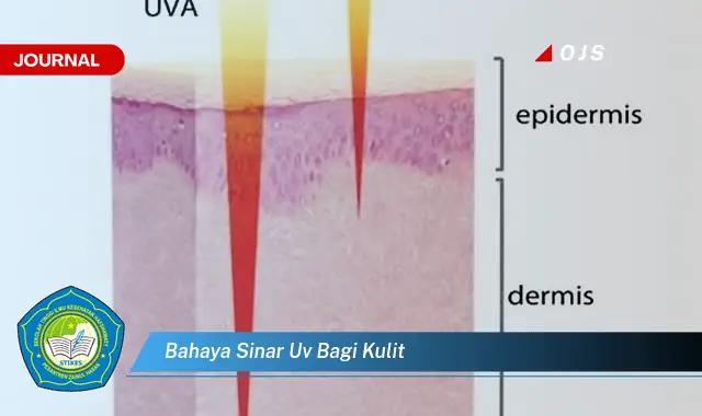 bahaya sinar uv bagi kulit