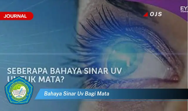 bahaya sinar uv bagi mata