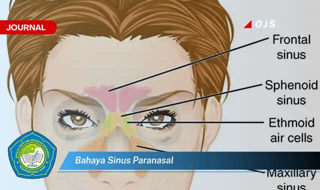 bahaya sinus paranasal