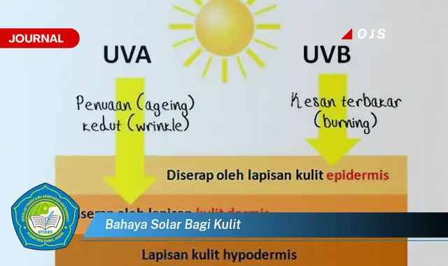 bahaya solar bagi kulit