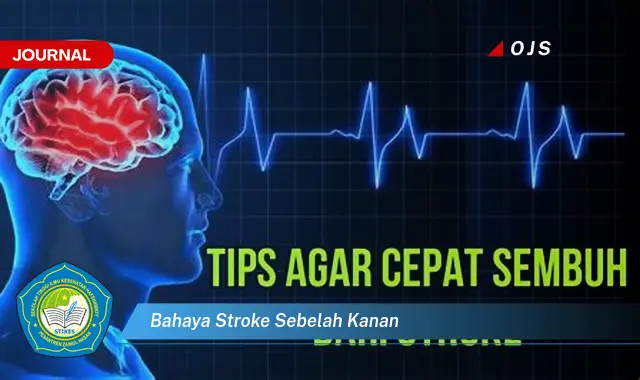 bahaya stroke sebelah kanan