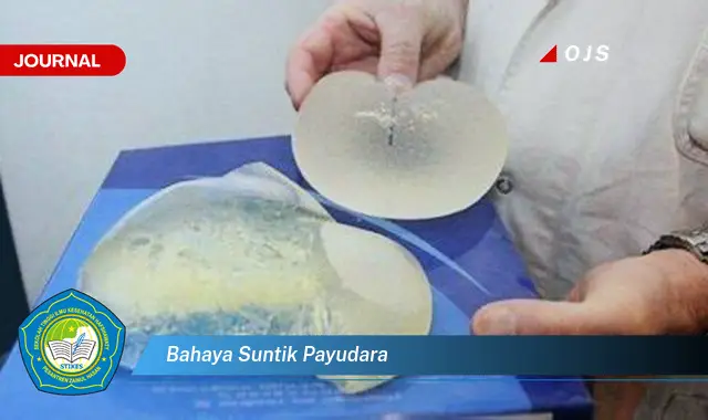 bahaya suntik payudara