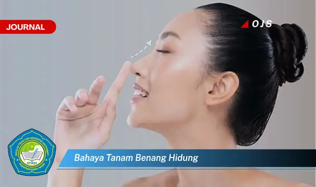 bahaya tanam benang hidung bahaya tanam benang hidung