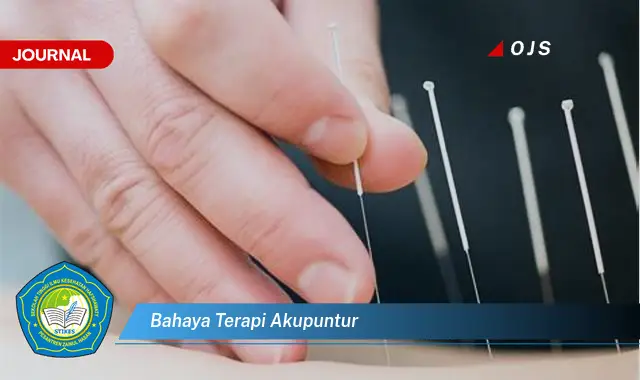 bahaya terapi akupuntur bahaya terapi akupuntur