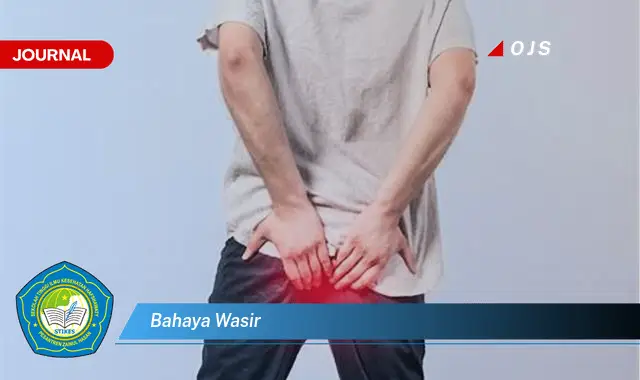 bahaya wasir