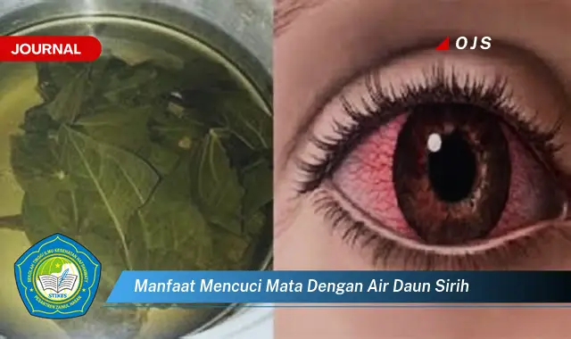 manfaat mencuci mata dengan air daun sirih