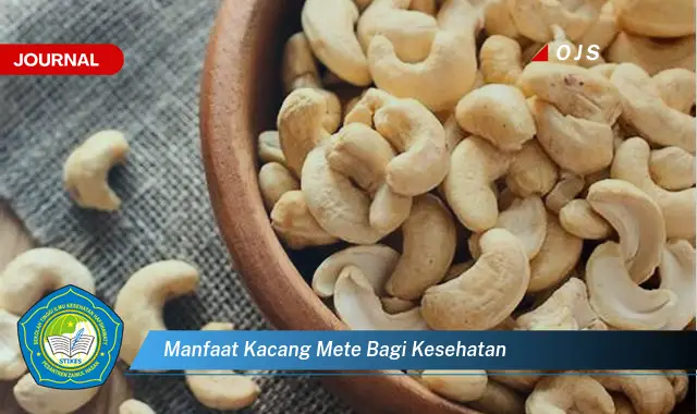 manfaat kacang mete bagi kesehatan