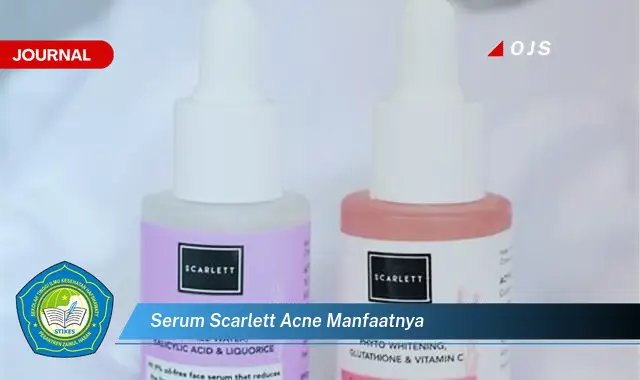 serum scarlett acne manfaatnya serum scarlett acne manfaatnya